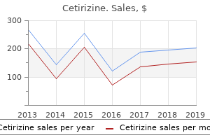 cost of cetirizine