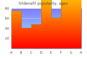 purchase cheapest sildenafil