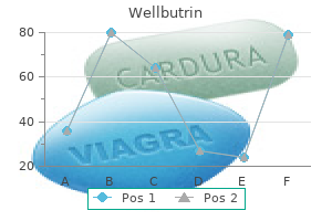 buy 300 mg wellbutrin with amex