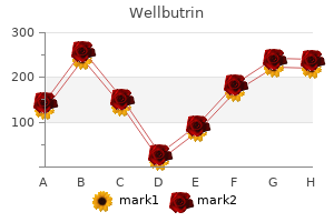 generic 300 mg wellbutrin amex