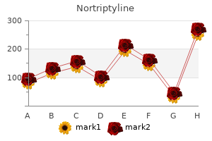 discount 25mg nortriptyline mastercard