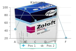order 50mg kamagra fast delivery