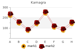 order 100 mg kamagra mastercard