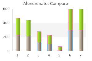 best order for alendronate