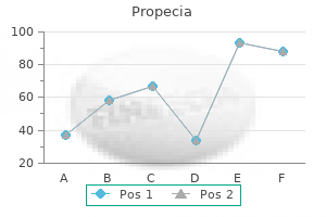 buy 1mg propecia overnight delivery